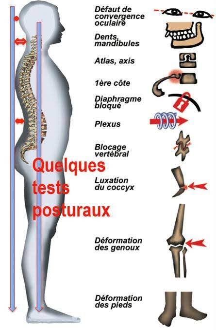 Quelques tests posturaux : convergence oculaire, mandibule, atlas, première côte, diaphragme, plexus, blocage vertébral, coccyx, genoux, pieds